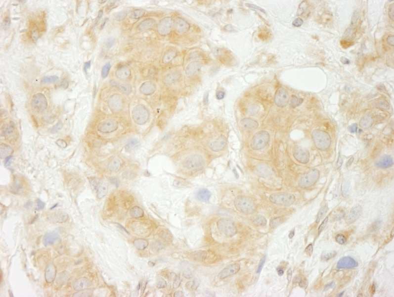 SEC23IP / p125 Antibody (aa350-400)