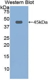 FBLN1 / Fibulin 1 Antibody (aa127-243, FITC)