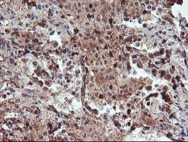 RFXANK Antibody (clone OTI3F5)