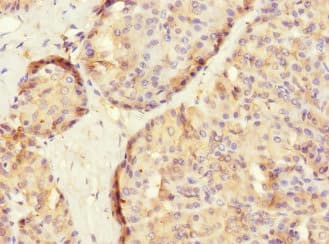 SLC2A13 / HMIT / GLUT13 Antibody