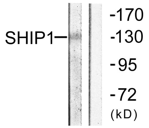 INPP5D / SHIP1 / SHIP Antibody (aa987-1036)