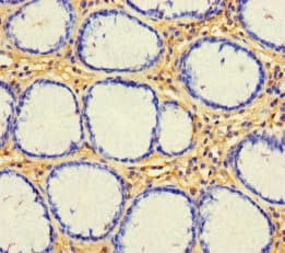 Polyclonal Rabbit anti-Human CX3CL1 / Fractalkine Antibody (WB)
