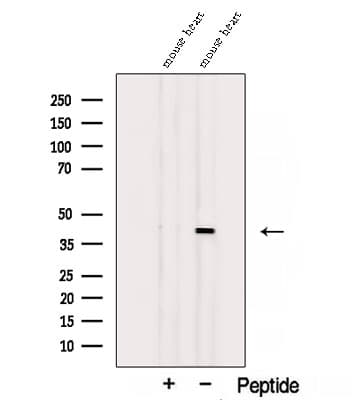 ST8SIA2 / STX Antibody