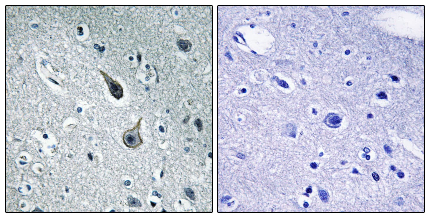 HTR2A / 5-HT2A Receptor Antibody (aa422-471)