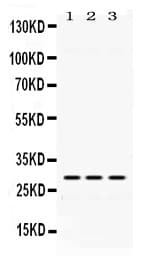 Polyclonal Rabbit anti-Human ADO Antibody (IHC, WB)