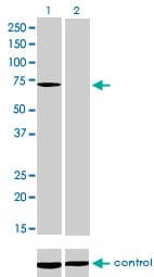MTM1 / Myotubularin Antibody (clone 1C10)