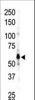 FGR Antibody (aa3-33)