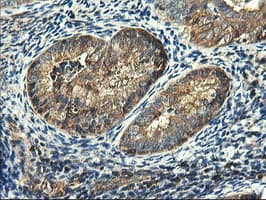 PFKP Antibody (clone OTI2F2, Carrier-free)