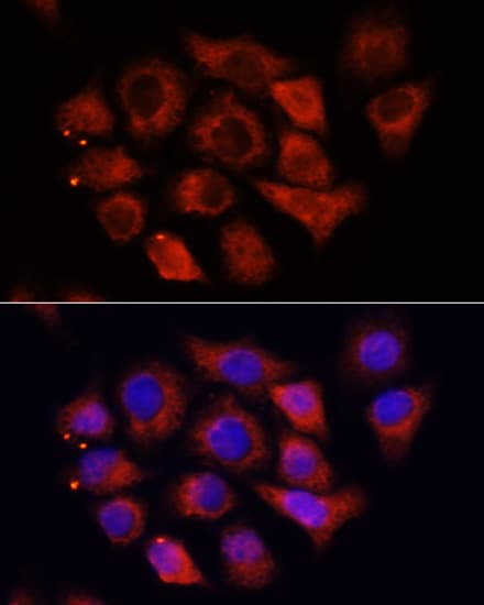 Polyclonal Rabbit anti-Human HMGIY / HMGA1 Antibody (IHC, IF, WB)