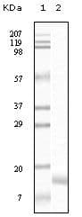 SNCG / Gamma-Synuclein Antibody (clone 1H10D2)