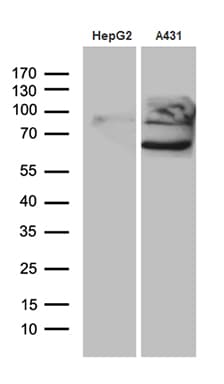 PCSK9 Antibody (aa153-692, clone OTI8C12, Carrier-free)