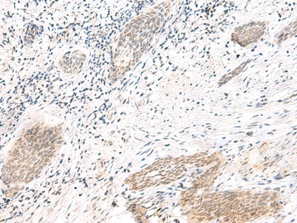 Polyclonal Rabbit anti-Human ARL2BP / BART Antibody (IHC)