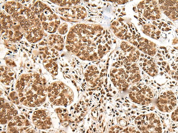 KIAA1811 / BRSK1 Antibody