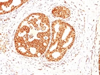 ESR2 / ER Beta Antibody (C-Terminus, clone ESR2/686, Ready-to-Use)