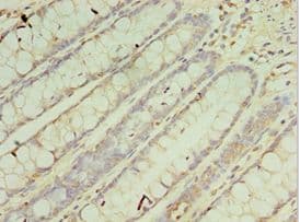 CRADD / RAIDD Antibody (aa1-199)