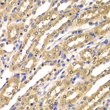 Polyclonal Rabbit anti-Human UBA3 / UBE1C Antibody (IHC, WB)
