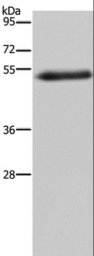 Polyclonal Rabbit anti-Human FOXC2 Antibody (WB)