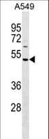 Polyclonal Rabbit anti-Human HAUS8 Antibody (aa28-54, WB)