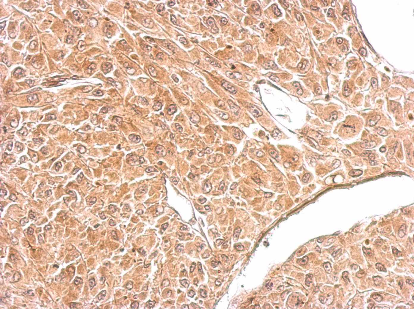 Polyclonal Rabbit anti-Human AMPH / Amphiphysin Antibody (aa1-194, IHC, WB)