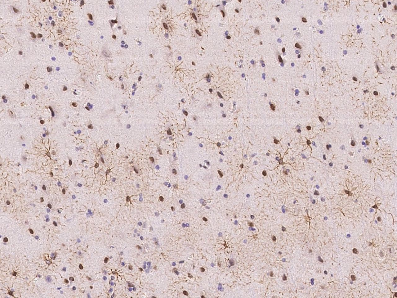 Polyclonal Rabbit anti-Human DAPK3 / ZIP Kinase Antibody (Preservative Free, IHC, IF)
