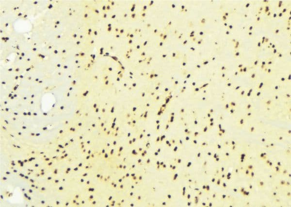 EP300 / p300 Antibody