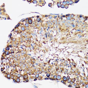 Polyclonal Rabbit anti-Human IRAK4 / IRAK-4 Antibody (IHC, WB)