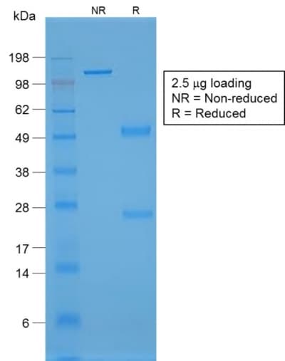 VWF / Von Willebrand Factor Antibody (aa1815-1939, clone rVWF/1465, Azide-free, Carrier-free)