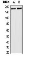 USP32 Antibody (Internal)
