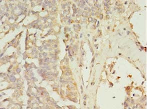 ZNF699 Antibody