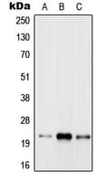 IHC-plus™ RAB31 Antibody (Internal)