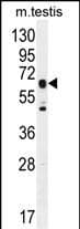 DNAAF3 Antibody (aa 181-210, Internal)