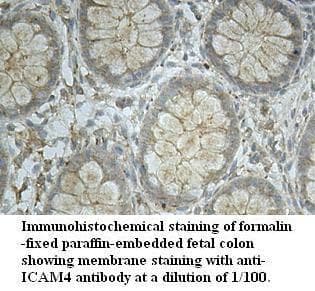 ICAM4 / CD242 Antibody (aa43-210)