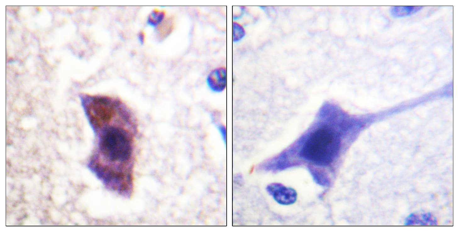 Polyclonal Rabbit anti-Human HRS / HGS Antibody (phospho-Tyr334, IHC, IF, WB)