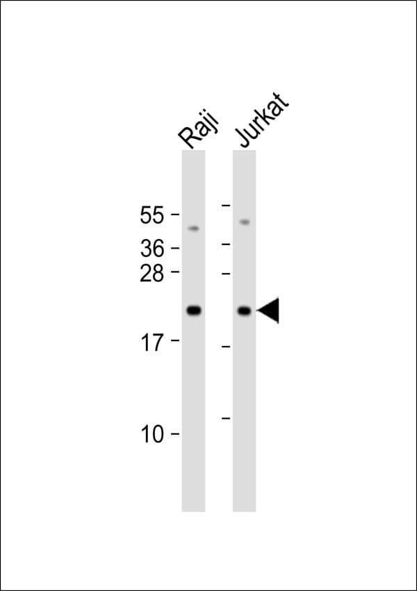 CBFB Antibody