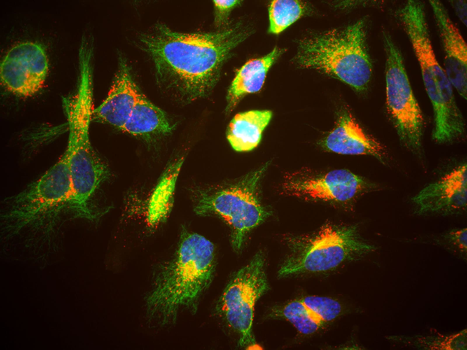 IHC-plus™ Monoclonal Mouse anti-Human LAMP1 / CD107a Antibody (clone 5H6, aa32-350, IHC, IF, WB)