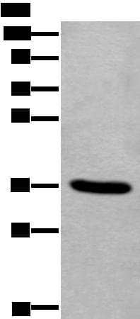 TNMD / Tenomodulin Antibody