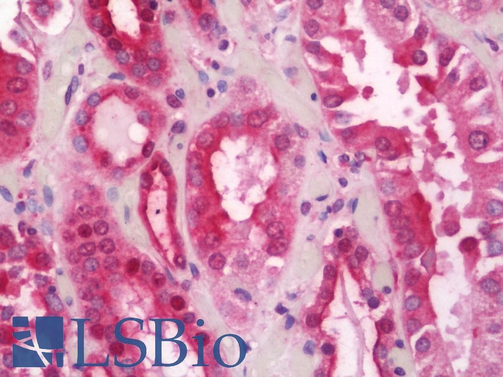 IHC-plus™ Polyclonal Rabbit anti-Human MYOF / Myoferlin Antibody (aa700-750, IHC, WB)