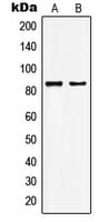 Polyclonal Rabbit anti-Human MYST2 / HBO1 Antibody (Internal, IF, WB)