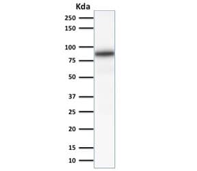 CANX / Calnexin Antibody (clone CANX/1541)