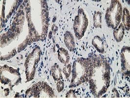 Monoclonal Mouse anti-Human 15-PGDH / HPGD Antibody (clone OTI1E9, IHC, WB)