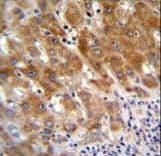 Polyclonal Rabbit anti-Human FAH Antibody (aa7-33, IHC, IF, WB)