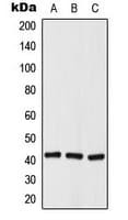 HDAC8 Antibody (phospho-Ser39)