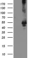 IHC-plus™ Monoclonal Mouse anti-Human TDO2 Antibody (clone 4G2, IHC, WB)