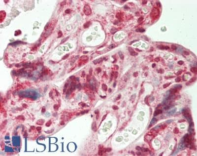IHC-plus™ Polyclonal Rabbit anti-Human NRXN3 Antibody (aa516-555, IHC, WB)