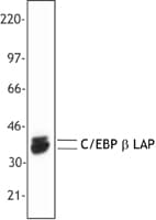 C/EBP Beta / CEBPB Antibody (clone A16)