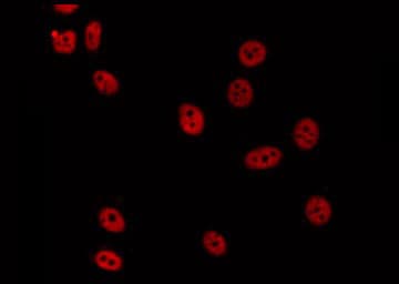 DDX51 Antibody