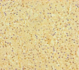 Polyclonal Rabbit anti-Human SP6 Transcription Factor Antibody