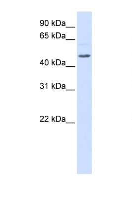 RGS11 Antibody (aa360-409)