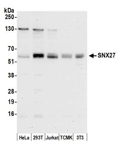 SNX27 Antibody (aa125-175)
