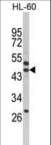 SERPINB7 / MEGSIN Antibody (aa108-137)
